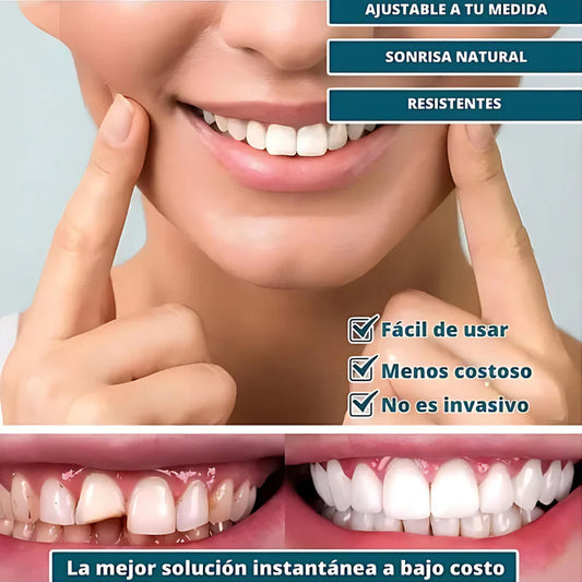 SmilePro - Carillas Dentales Ajustables De Resina