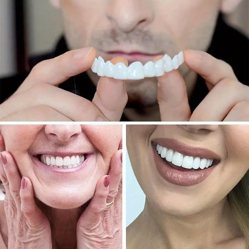 SmilePro - Carillas Dentales Ajustables De Resina