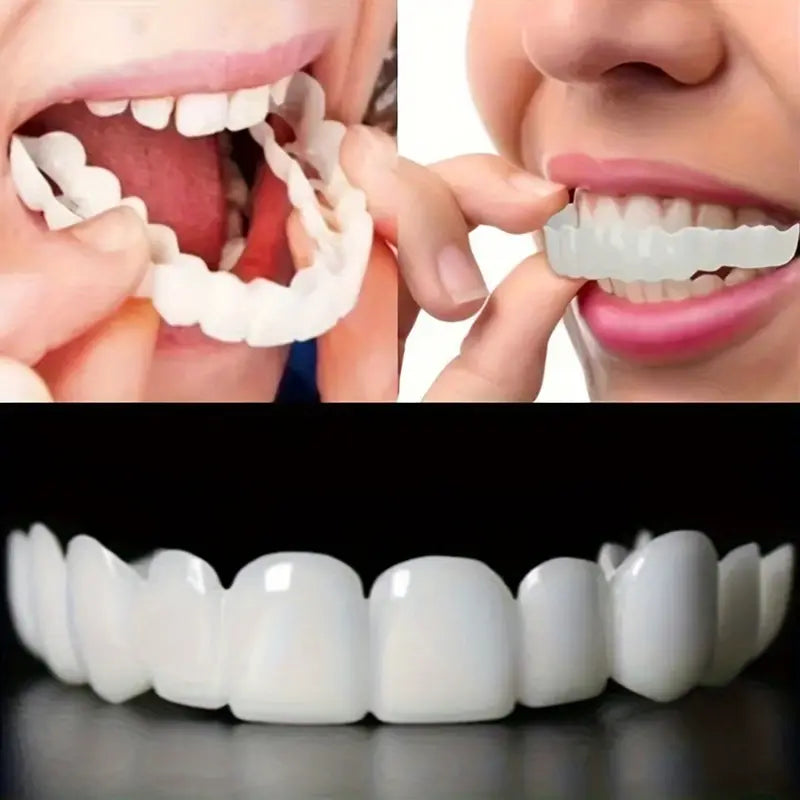 SmilePro - Carillas Dentales Ajustables De Resina